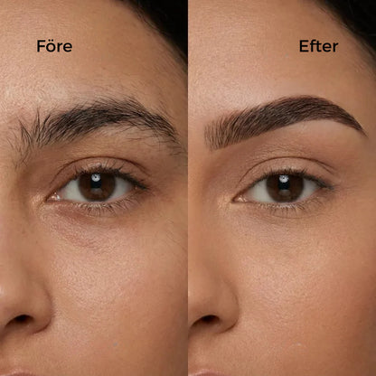 DailyBeauty™ – Smärtfri, Hygienisk Hårborttagning